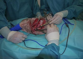 Cirugía resección pared costal 8